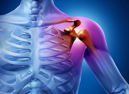 Luxación de Hombro - Enfermedad tratada por el Dr. Miguel Angel Barrios Andaluz